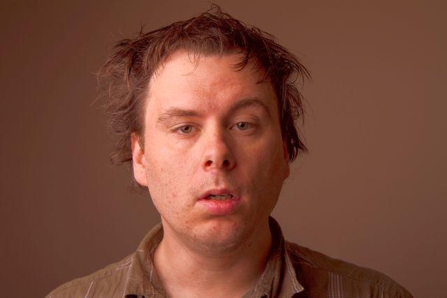 Crvenilo u licu usled konzumacije alkohola nije naivna stvar